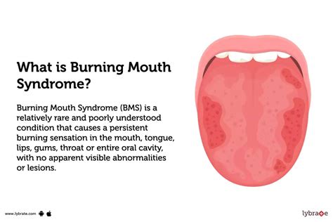 does salt water rinse help burning mouth syndrome|burning mouth syndrome without treatment.